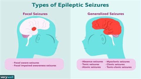 Does epilepsy affect education?