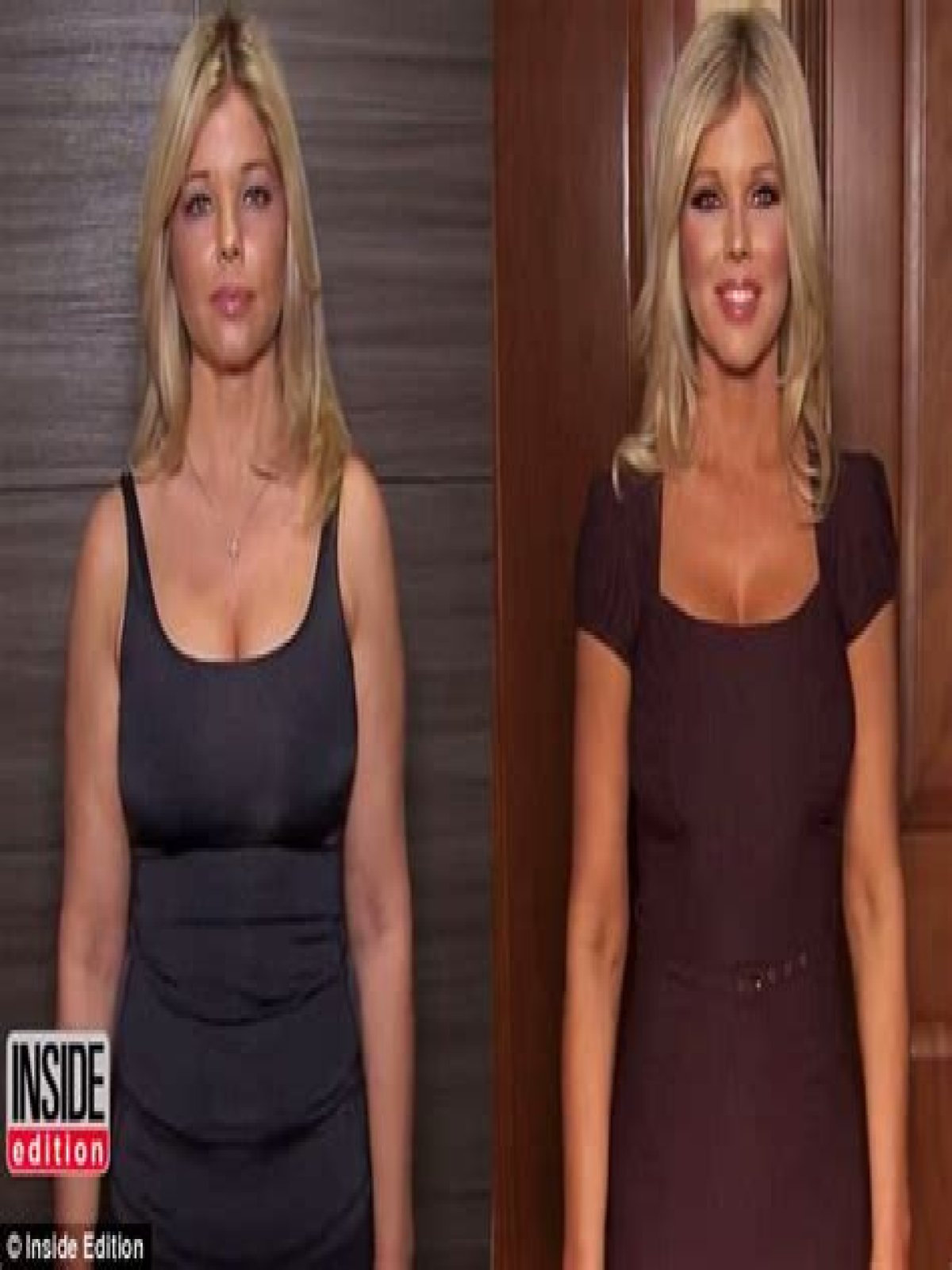 Donna D’Errico of Baywatch, 49, on her four plastic surgery procedures in a day