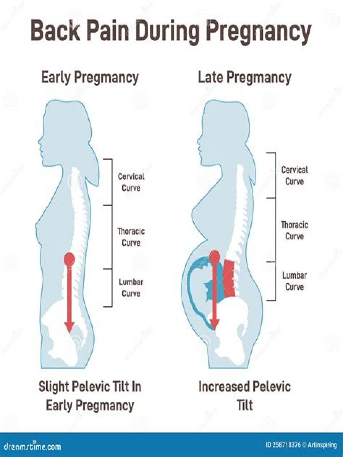 Is cramping and back pain normal at 4 weeks pregnant?