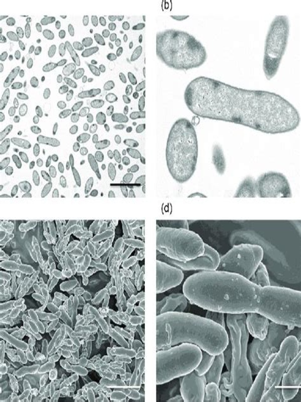 Is dialister pneumosintes smallest bacteria?
