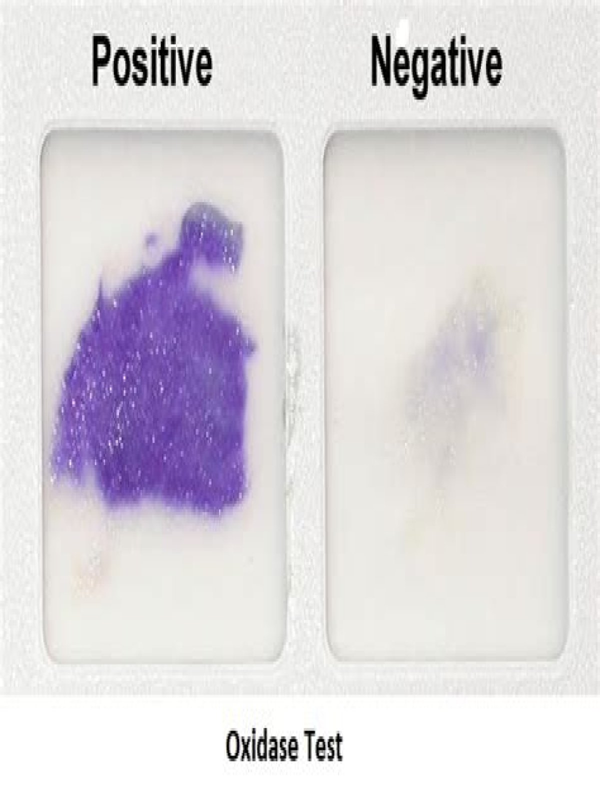 Is E coli oxidase negative?