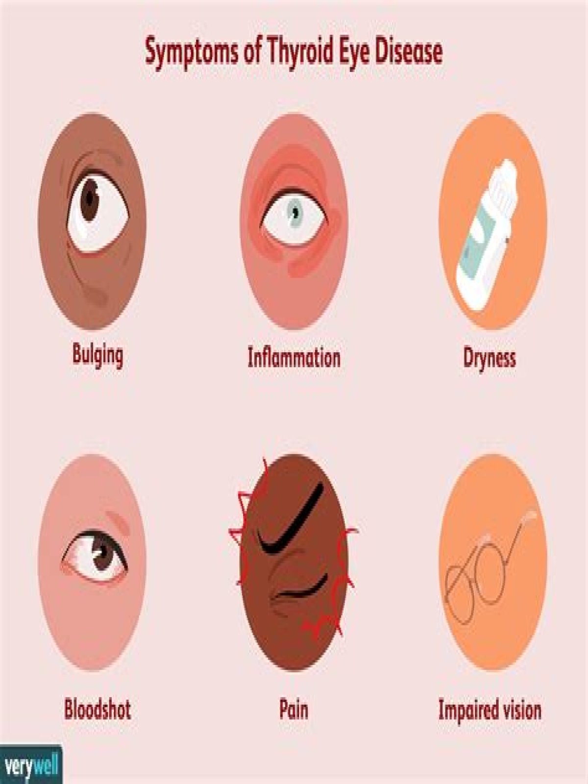 Is thyroid eye disease a disability?
