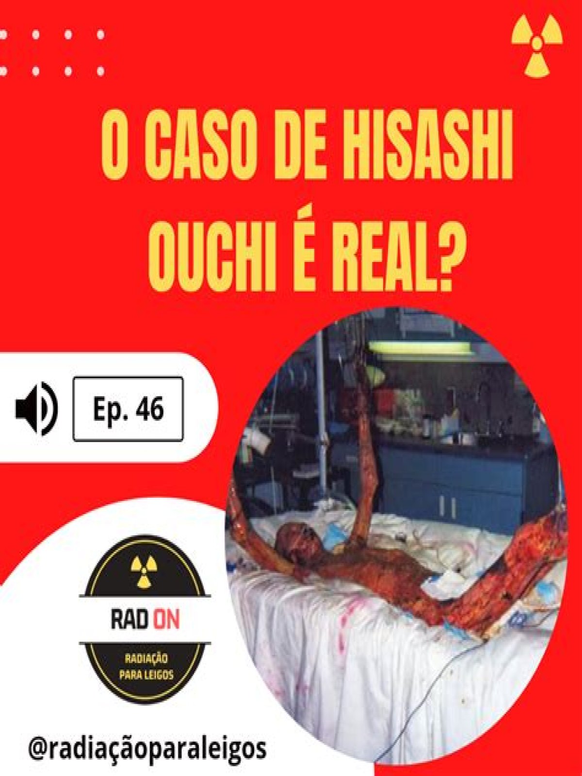 Unraveling The Mystery Behind Hisashi Ouchi Photo