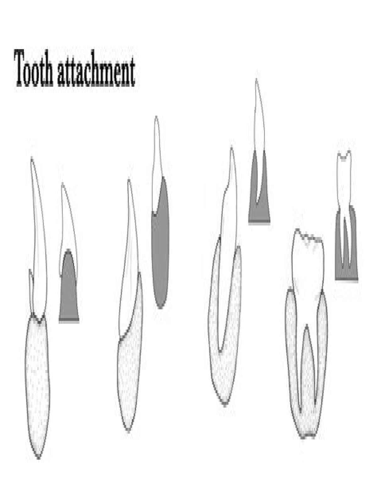 What is thecodont type of dentition?